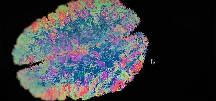 Uma startup que ajuda a identificar Alzheimer e Parkinson